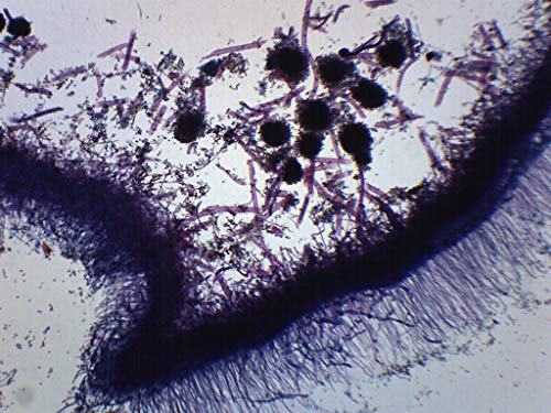 Aspergillus (Kahverengi Kalıp), Bütün Montajlı Mikroskop Lamı-75 x 25mm-Biyoloji ve Mikroskopi-Eısco Labs